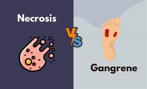 necrosis vs gangrene